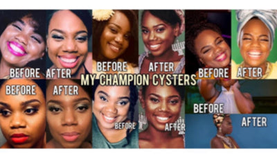 “My Champion Cysters” FB Group